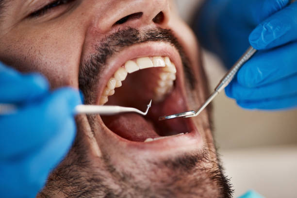 Best Emergency Treatment for Toothache in Sulphur, OK